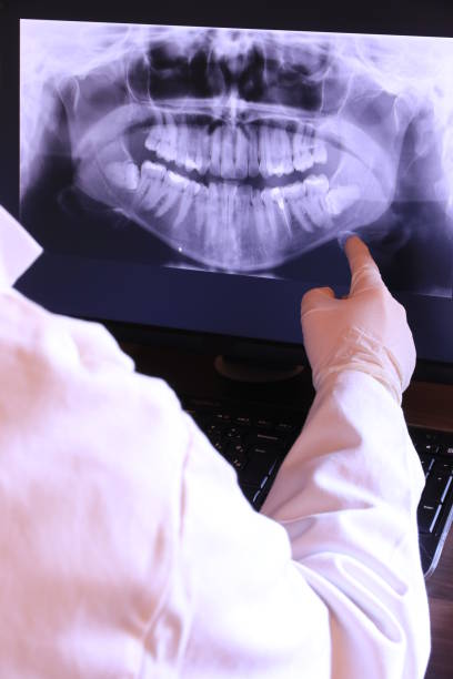Best Emergency Wisdom Tooth Extraction in North Cape May, NJ