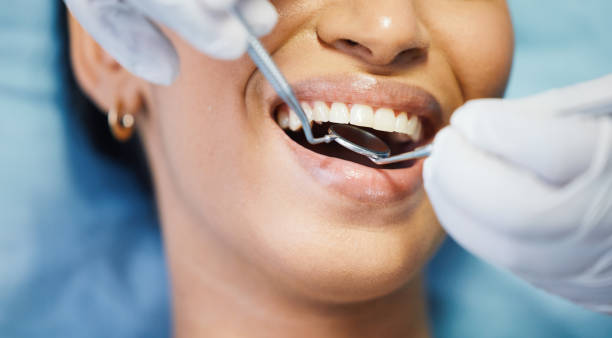 Best Emergency Treatment for Oral Infections in North Cape May, NJ